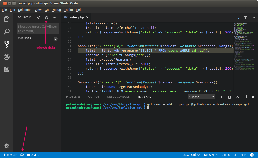 git in visual studio code